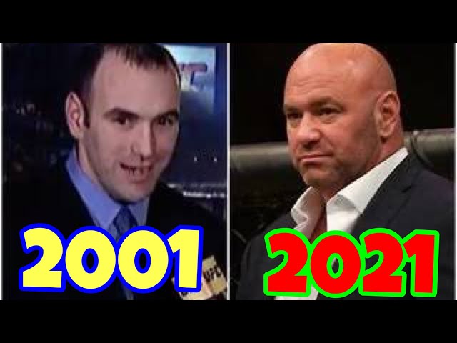 From Bald to Hair: Dana Whites Unbelievable Before and After