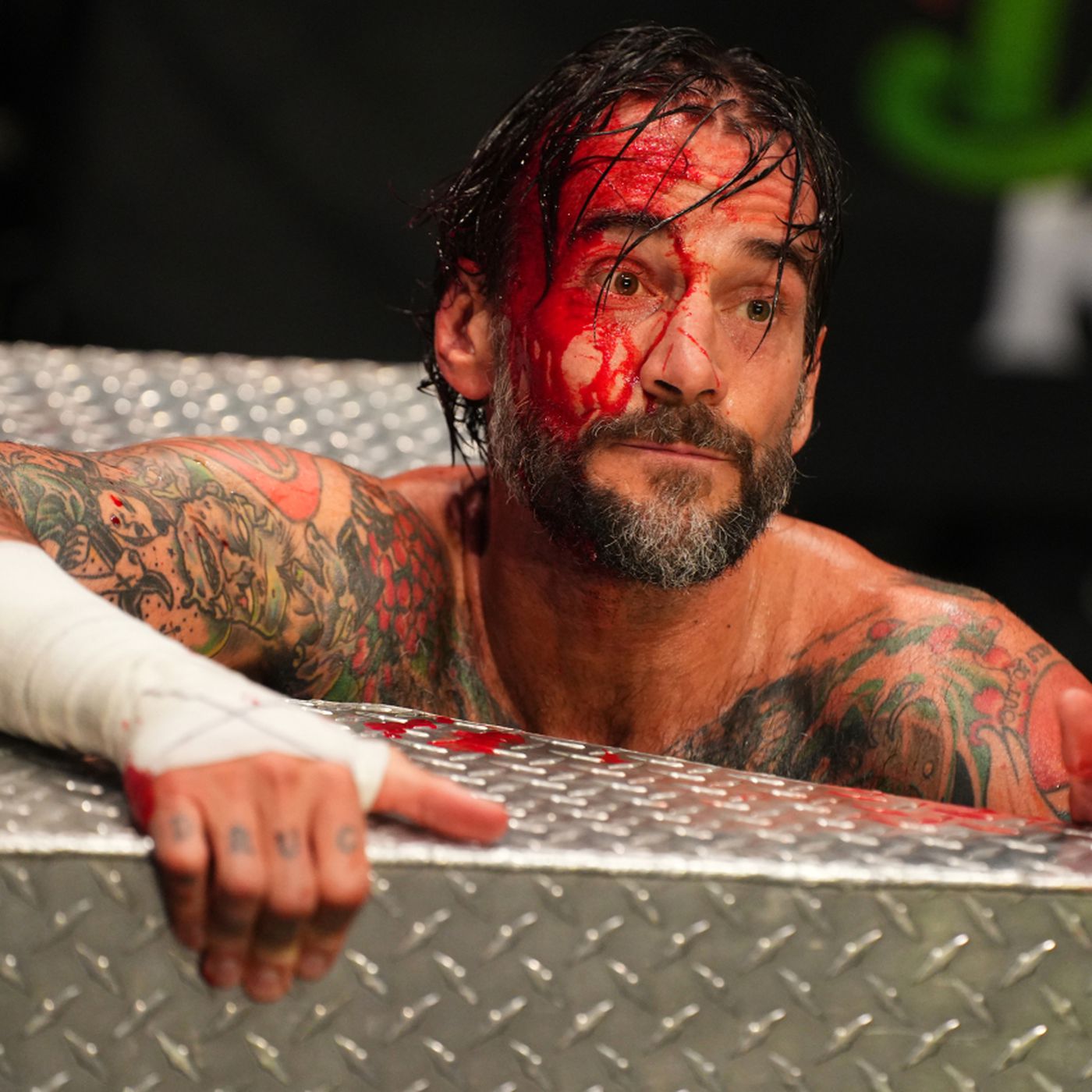 CM Punk Injured What Happened and When Can We Expect to See Him Back.