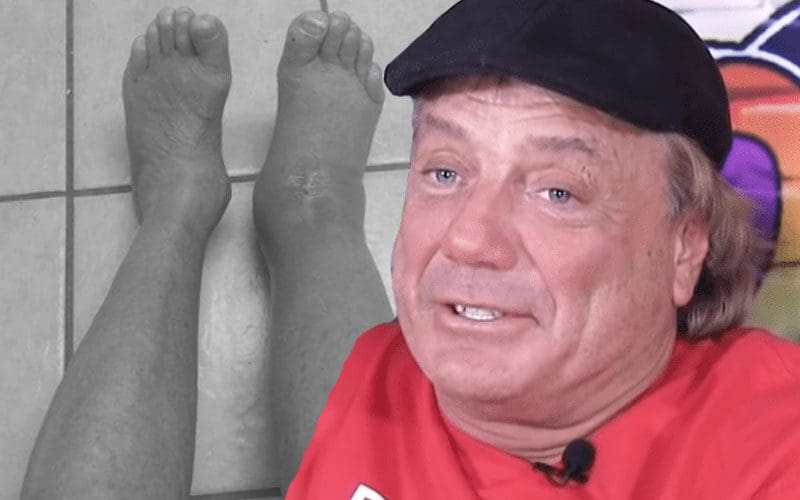 After the Marty Jannetty Foot Injury: The Road to Recovery.