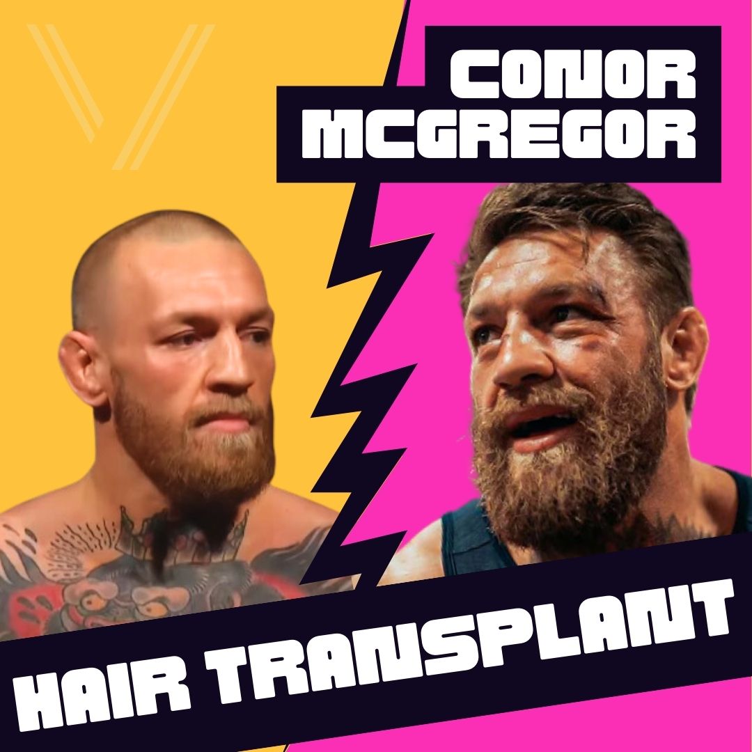 Fans Ask About Conor McGregor Hair Loss - Heres What We Know