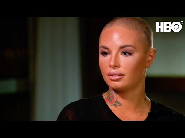 The Christy Mack Before and After Everyones Talking About